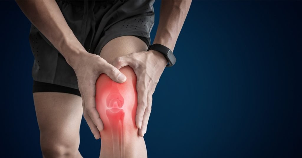 What is Arthritis?