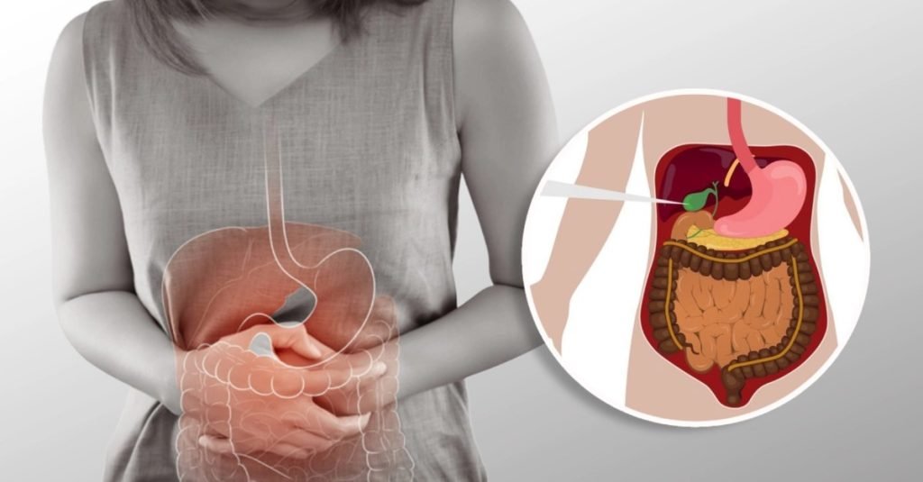 Gallbladder Stone: Causes, Symptoms, Ayurvedic Remedies