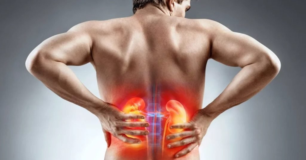 Prevention of Kidney Stones
