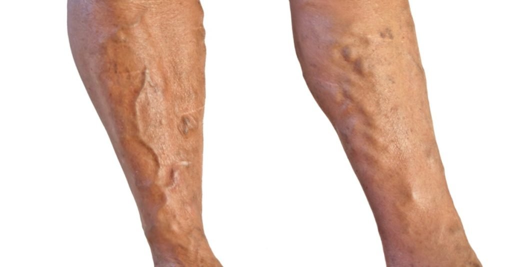 🏠 Effective Home Remedies 
