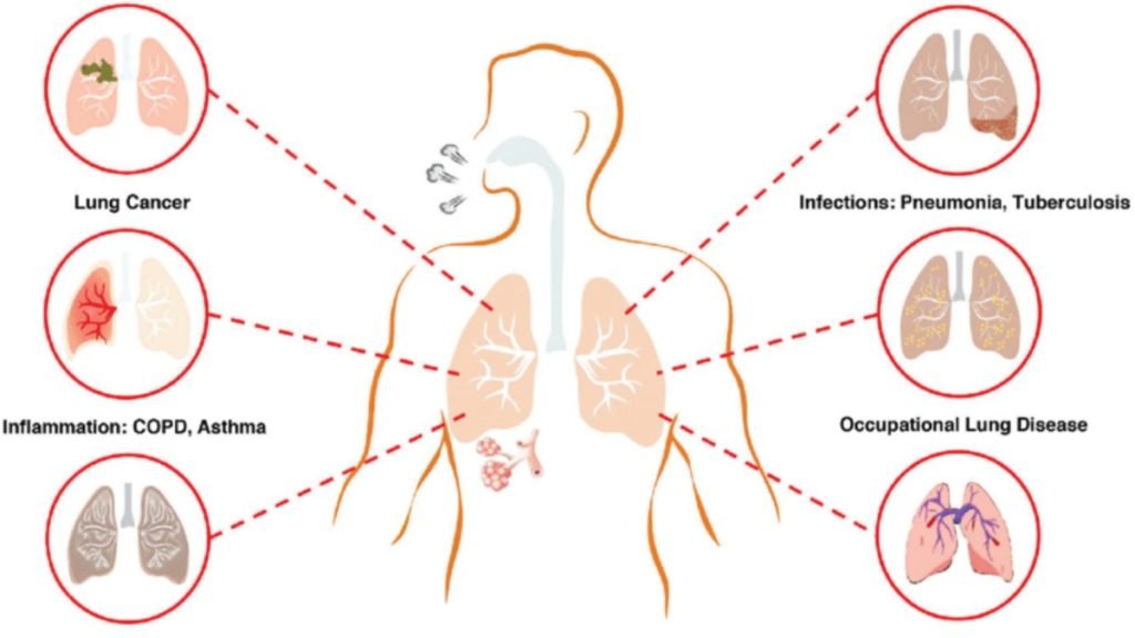 ⚕️ Causes of Respiratory Problems
