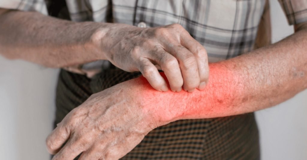 🌿 Why Choose Jeevan Ayurveda for Skin Allergy Treatment