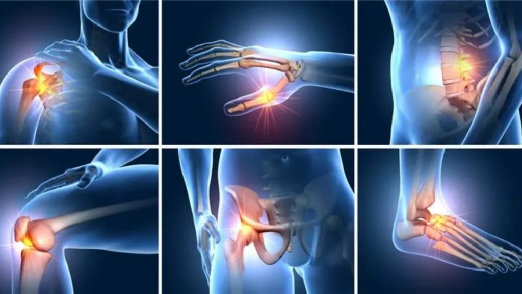 🔍 Symptoms of Joint Pain