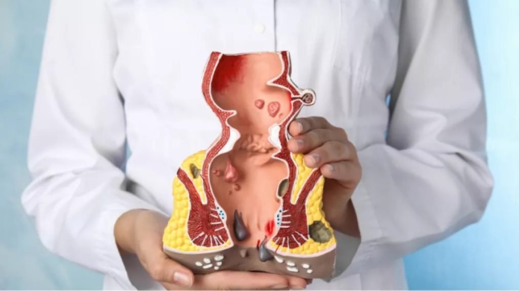 Jeevan Ayurveda for natural, safe, and permanent piles treatment