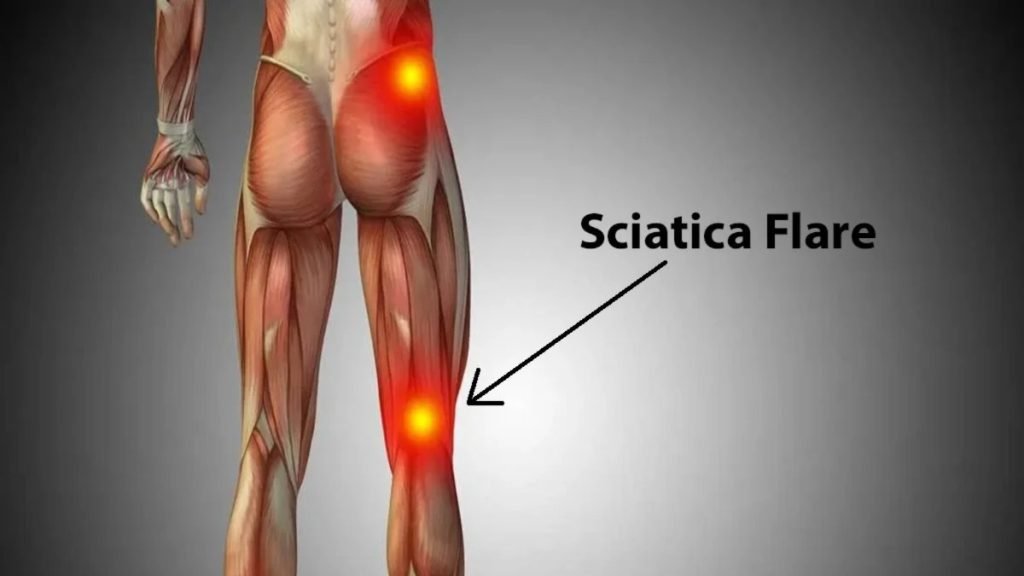 Modern Treatments for Sciatica