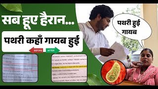 Gallstone Testimonial with Reports