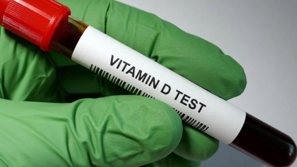 📌 Vitamin D की कमी का टेस्ट कब करवाएं