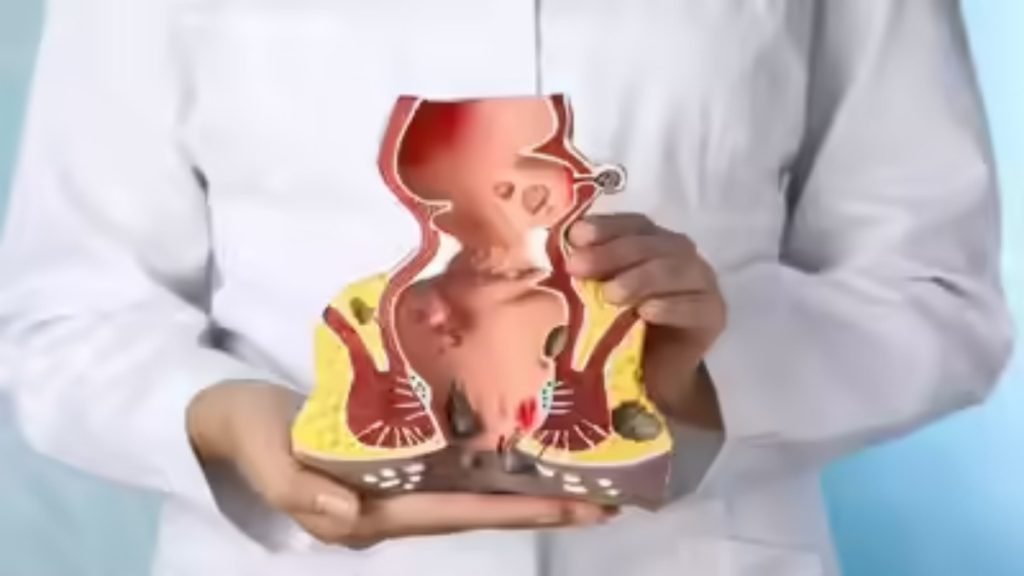 बवासीर में ज्यादा खून आने के मुख्य कारण