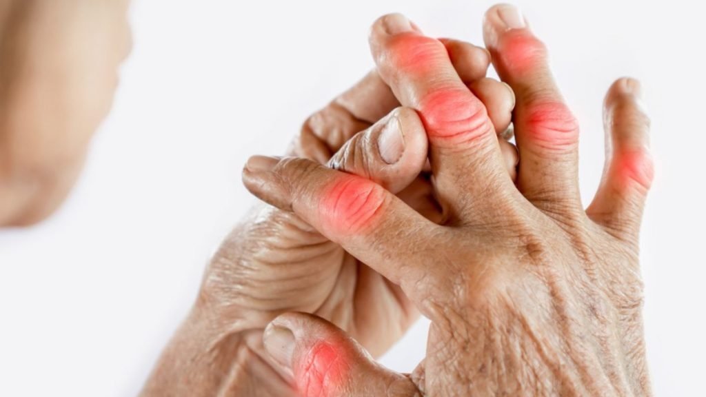 रूमेटॉइड आर्थराइटिस क्या है