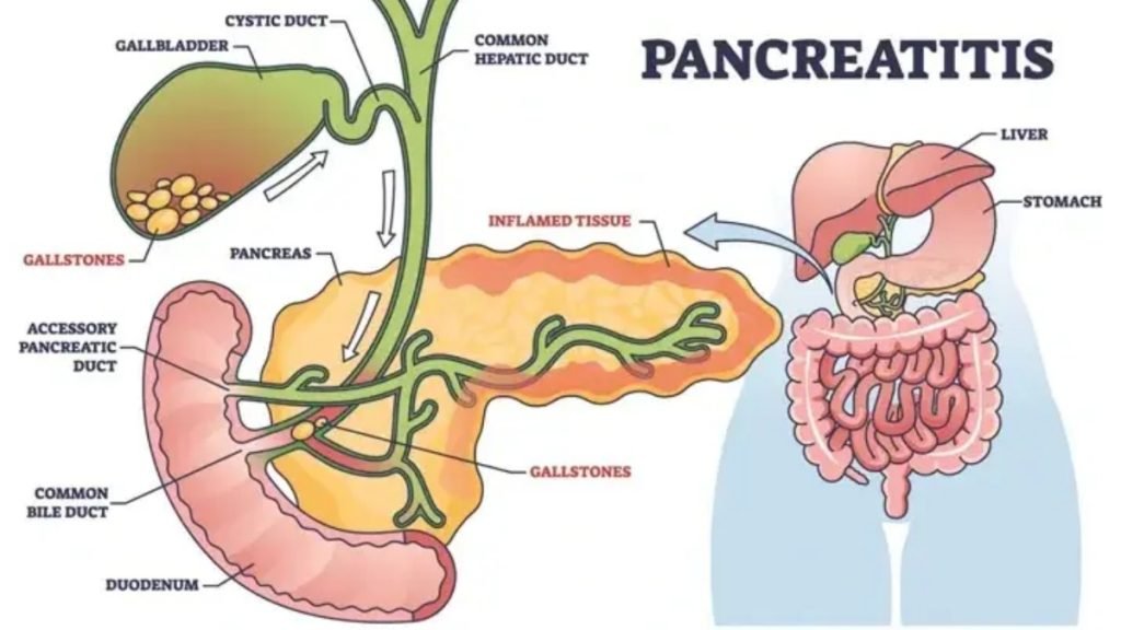 7. अग्न्याशय (Pancreas) – शुगर नियंत्रण