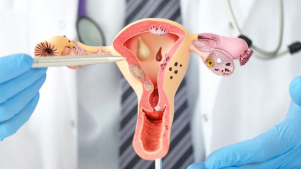 पीरियड्स नहीं आ रहे