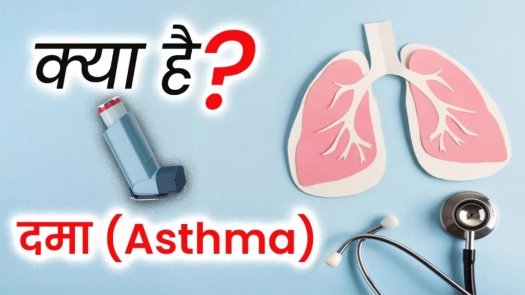 अस्थमा क्या है? (What is Asthma?)