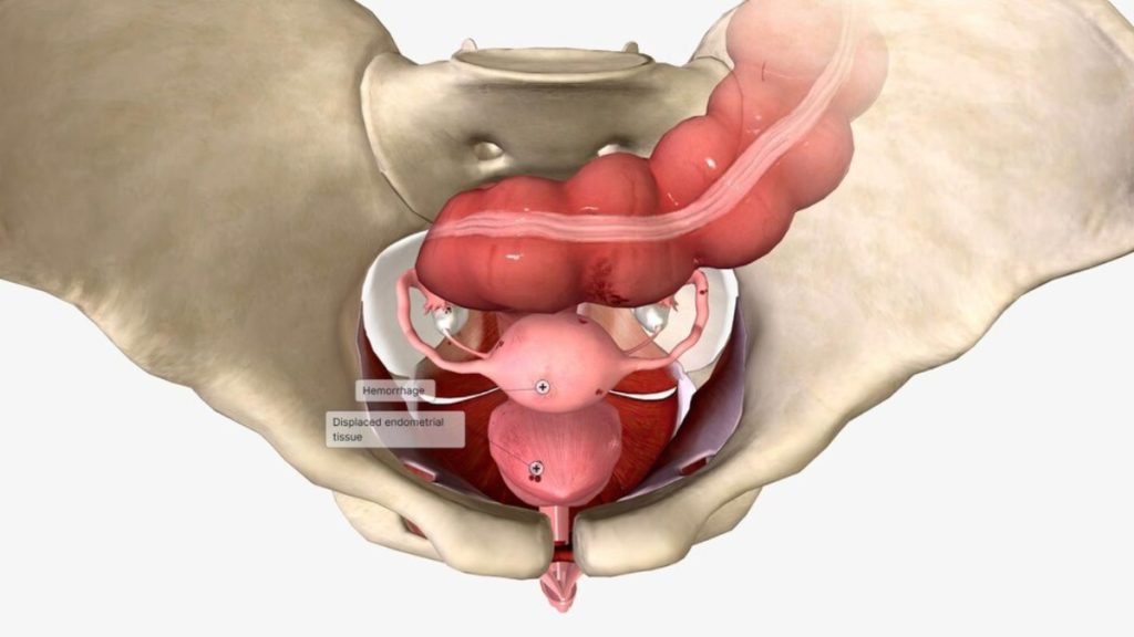 Jeevan Ayurveda में गुदा भ्रंश का आयुर्वेदिक उपचार