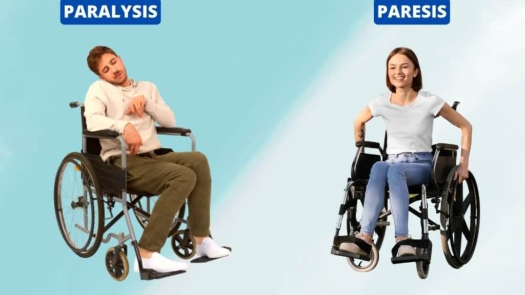 Paralysis क्यों होता है (लकवा होने के मुख्य कारण)