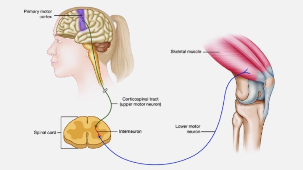 Paralysis (लकवा) क्या होता है