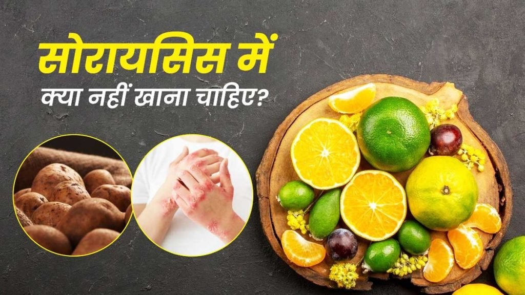 Psoriasis में क्या खाएं और क्या न खाएं