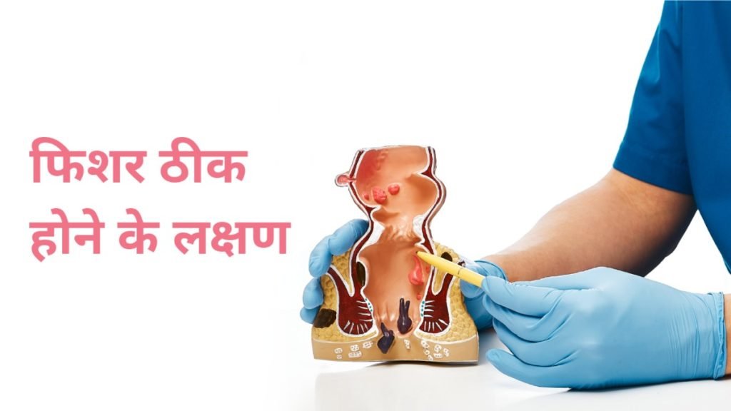 क्या बिना ऑपरेशन Anal Fissure ठीक हो सकता है