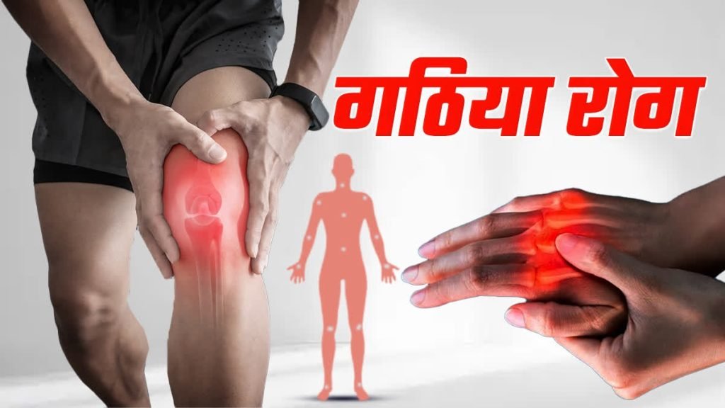 गठिया में सूजन आ रही है तो क्या करें जानिए आयुर्वेदिक समाधान