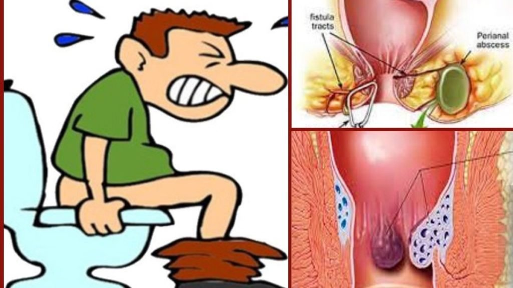 रोज मवाद आने के लक्षण