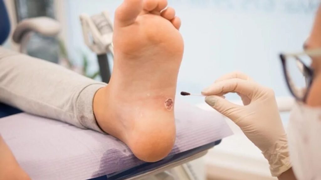 Gangrene किस कारण से होता है जानिए कारण और आयुर्वेदिक उपचार