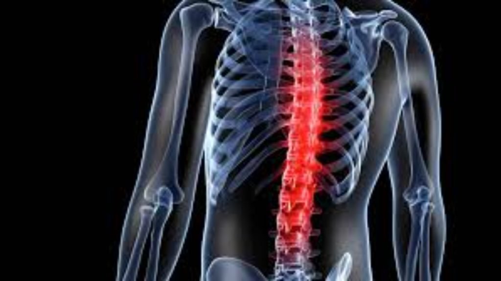 Jeevan Ayurveda में Ankylosing Spondylitis का उपचार