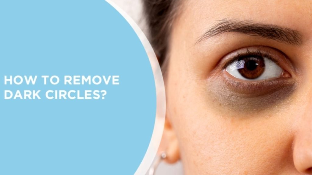 आँखों के डार्क सर्कल कैसे ठीक करें (आयुर्वेदिक उपचार)