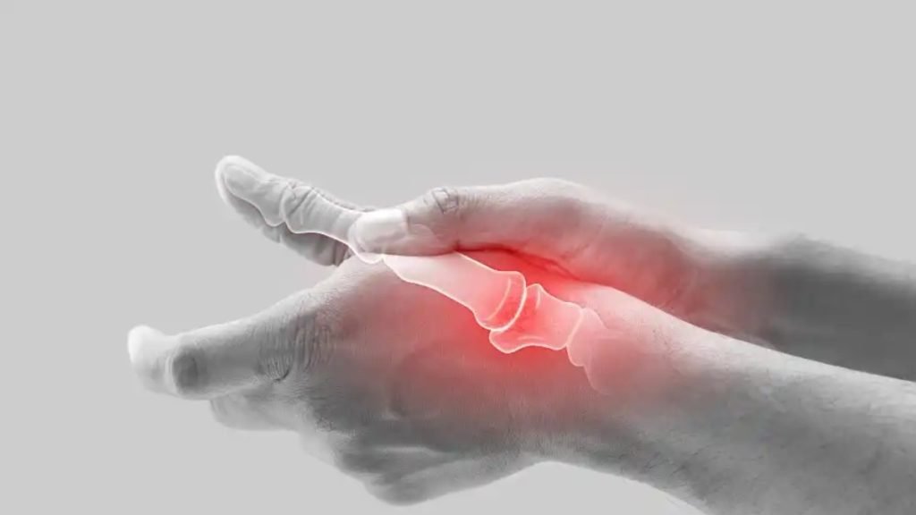 आयुर्वेद में गठिया का जड़ से इलाज कैसे होता है?