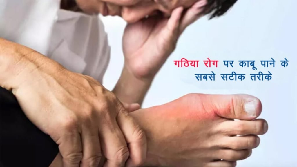 क्या गठिया रोग जड़ से खत्म हो सकता है?