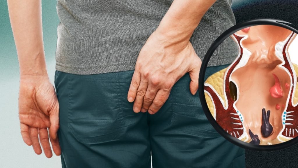 क्या फिशर आयुर्वेद से पूरी तरह ठीक हो सकता है?