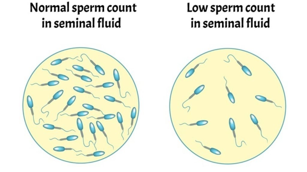 स्पर्म काउंट क्या होता है