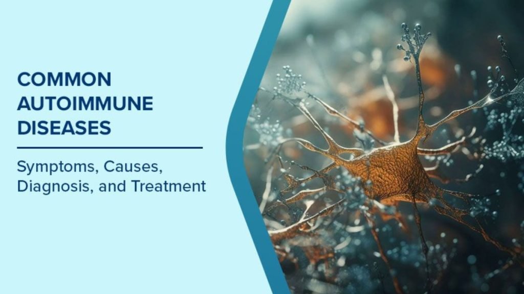 Autoimmune Disease क्या है कारण, लक्षण और आयुर्वेदिक उपचार