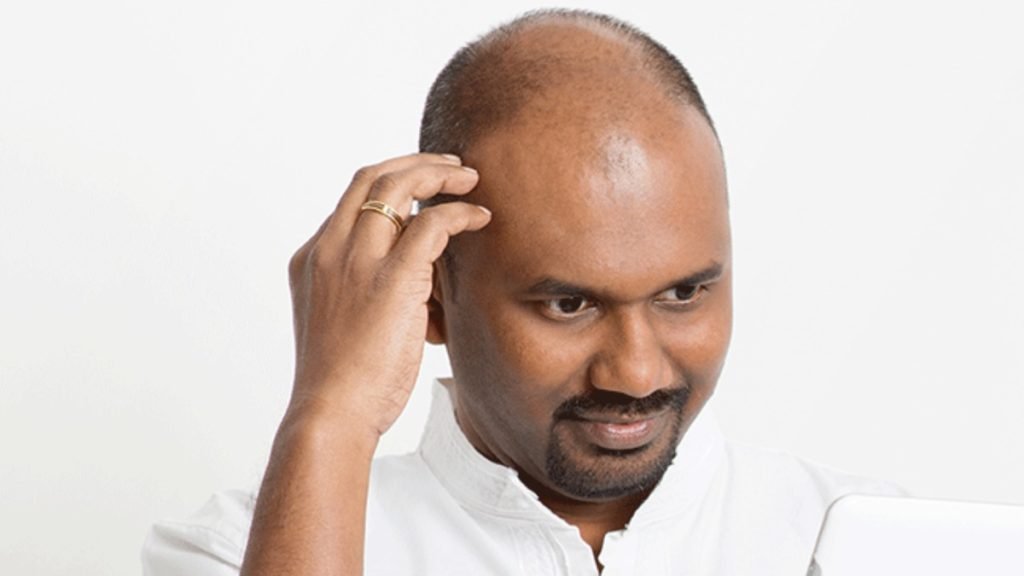 Hair Fall क्या है