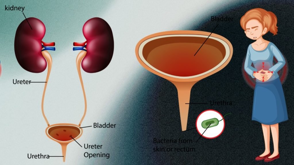 UTI का आयुर्वेदिक उपचार  Jeevan Ayurveda