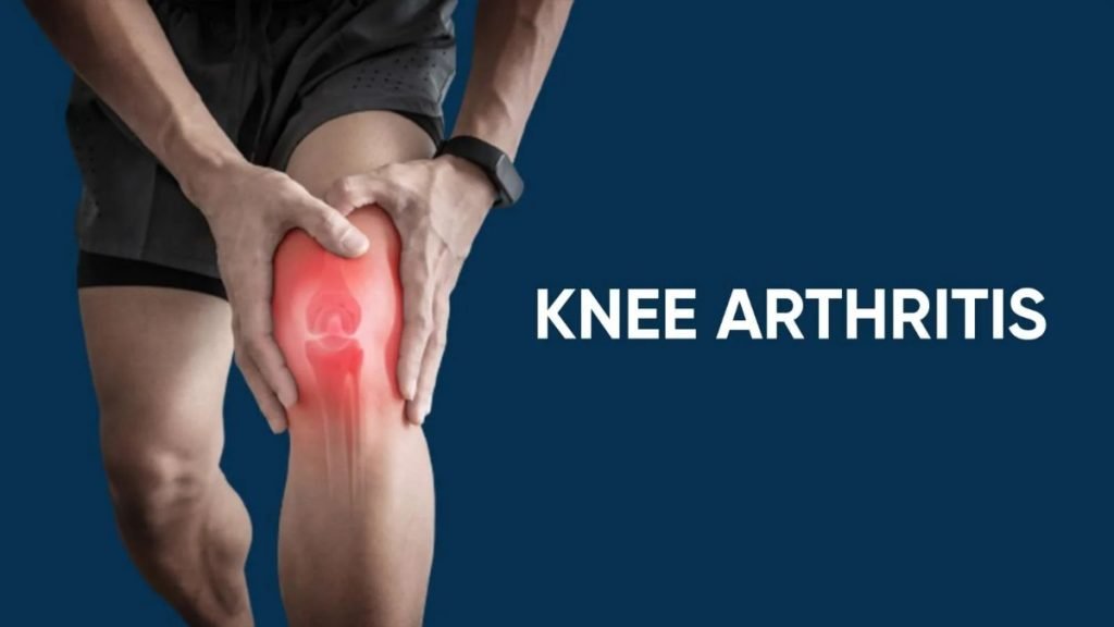 घुटनों का गठिया कैसे ठीक करें – आयुर्वेदिक उपचार और घरेलू उपाय