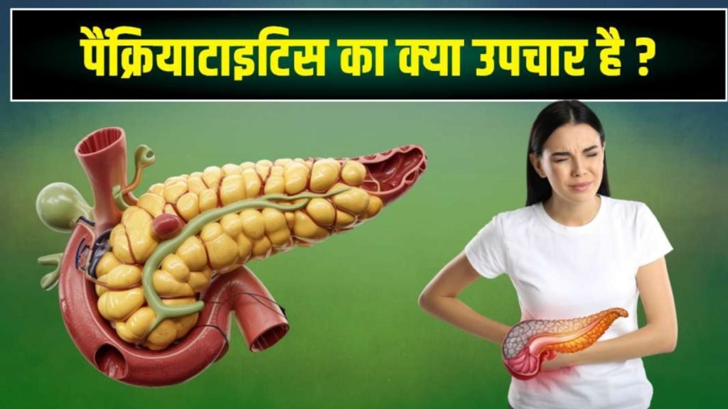 पैनक्रियास स्टोन कैसे होता है By Jeevan Ayurveda