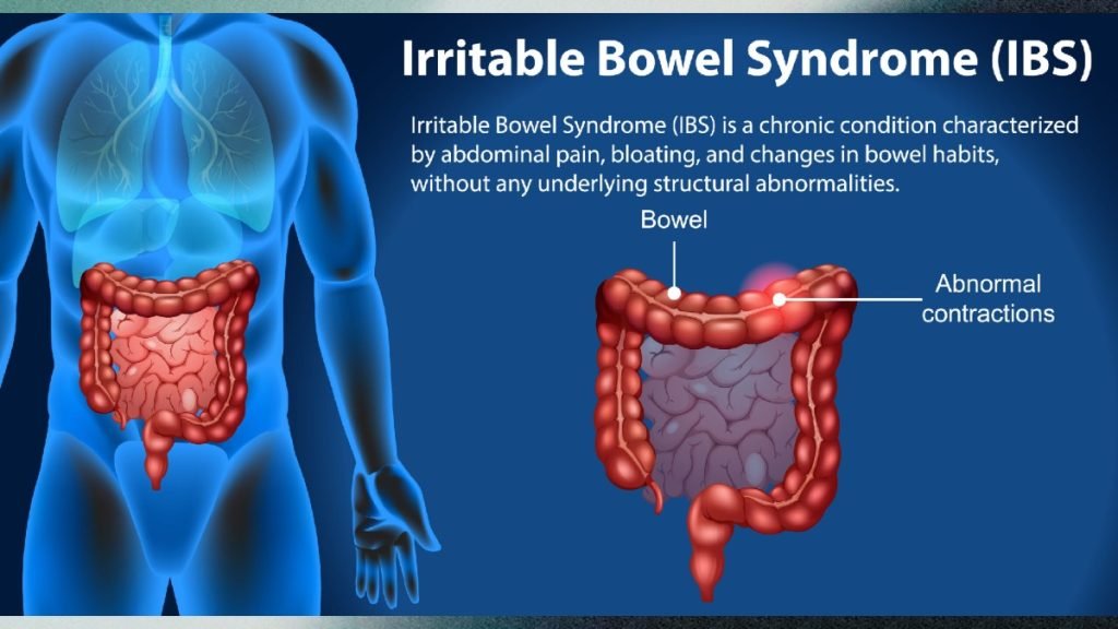 IBS क्या है कारण, लक्षण और आयुर्वेदिक उपचार Jeevan Ayurveda