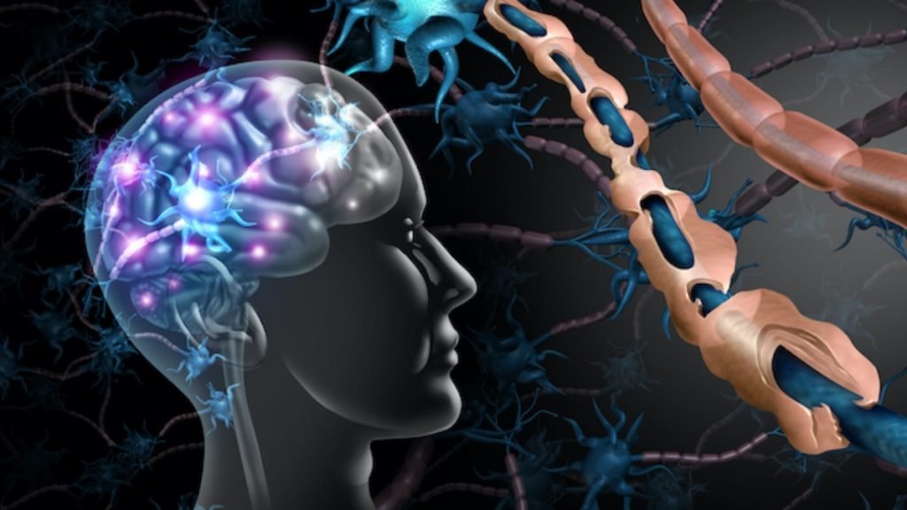 ⚠️ मल्टीपल स्क्लेरोसिस के प्रमुख कारण