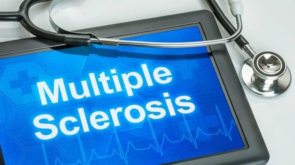 🧪 MS के प्रकार (Types of Multiple Sclerosis)